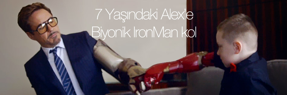 Biyonik Kol